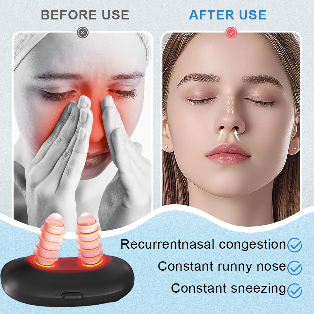Mresio® Allergic Rhinitis Relief Device
