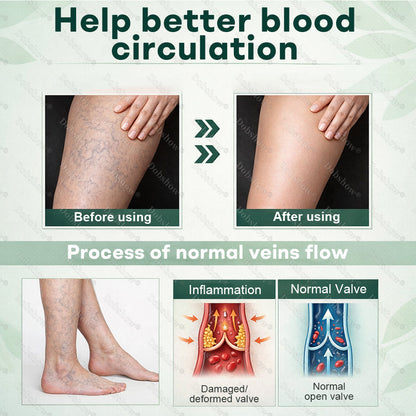 Healrize® 𝐋𝐲𝐦𝐩𝐡𝐃𝐫𝐚𝐢𝐧 𝐇𝐞𝐫𝐛𝐚𝐥 𝐒𝐨𝐨𝐭𝐡𝐢𝐧𝐠 𝐂𝐫𝐞𝐚𝐦