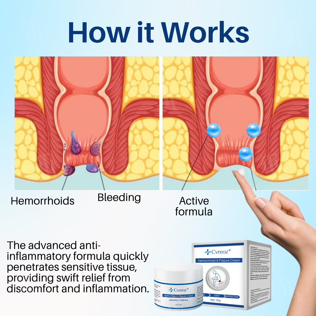 Cvreoz® 𝐇𝐞𝐦𝐨𝐫𝐫𝐡𝐨𝐢𝐝 & 𝐅𝐢𝐬𝐬𝐮𝐫𝐞 𝐂𝐫𝐞𝐚𝐦
