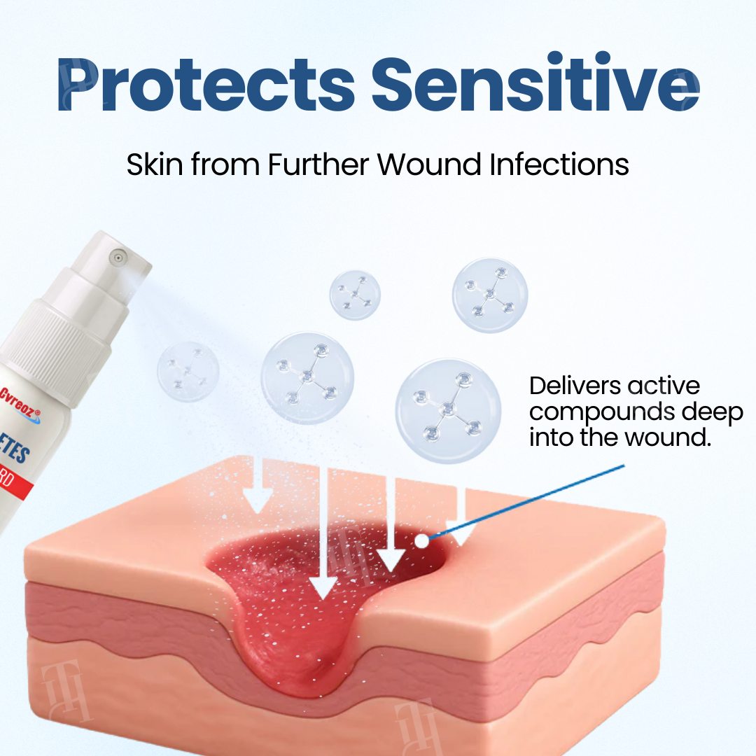 Cvreoz®  𝐃𝐢𝐚𝐛𝐞𝐭𝐞𝐬 𝐅𝐨𝐨𝐭 𝐆𝐮𝐚𝐫𝐝 𝐑𝐞𝐜𝐨𝐯𝐞𝐫𝐲 𝐒𝐩𝐫𝐚𝐲