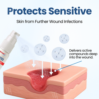 Cvreoz®  𝐃𝐢𝐚𝐛𝐞𝐭𝐞𝐬 𝐅𝐨𝐨𝐭 𝐆𝐮𝐚𝐫𝐝 𝐑𝐞𝐜𝐨𝐯𝐞𝐫𝐲 𝐒𝐩𝐫𝐚𝐲