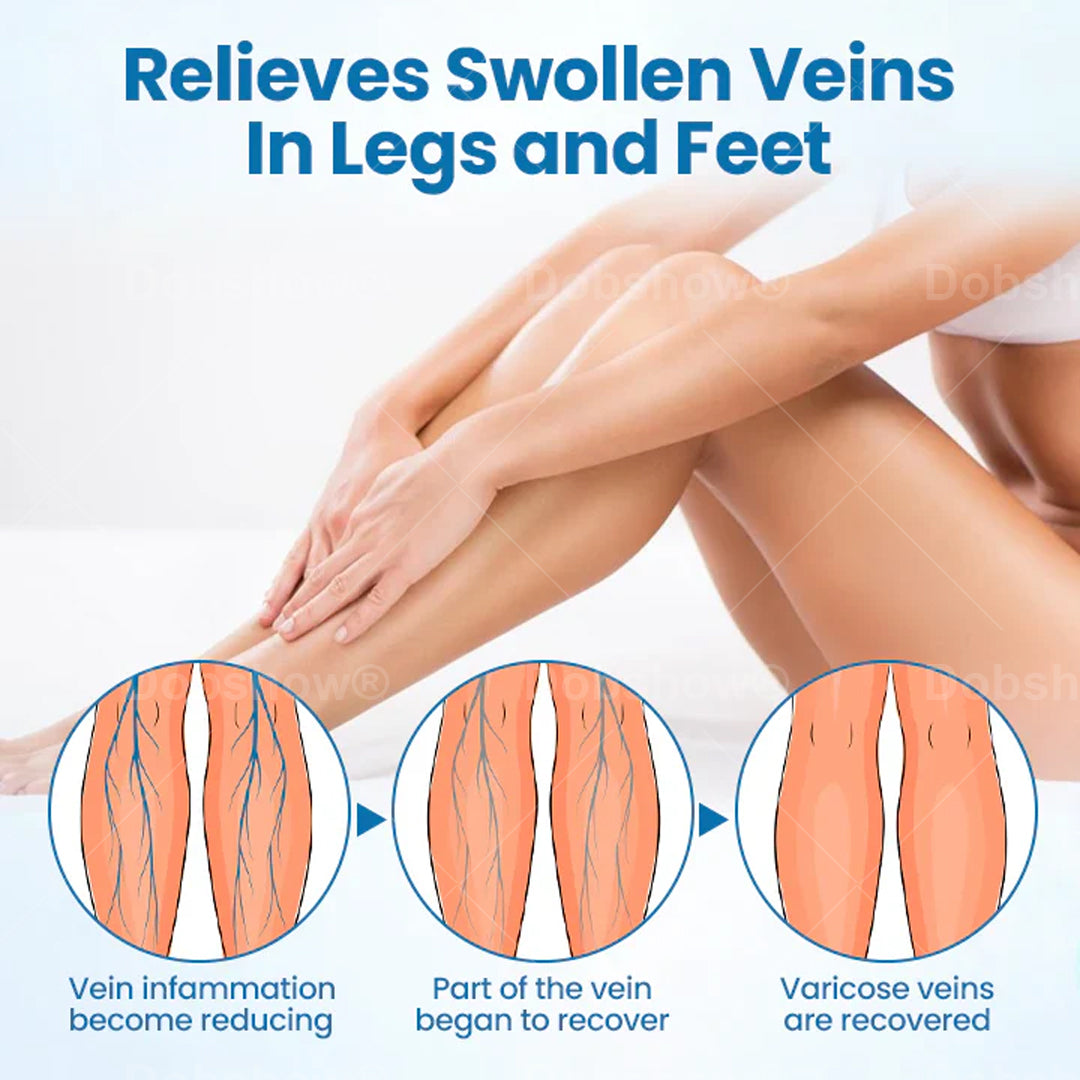 Cvreoz® VeinGuard Herbal Spray-✅ Clinically proven to eliminate varicose veins in just 7 days!