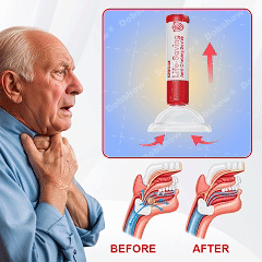 Nurbini® Life-Saving Anti-Choking Device