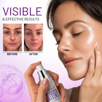 🔥Final 3 Hours: 80% OFF: Dobshow® Lumi-Bio Spot Corrector