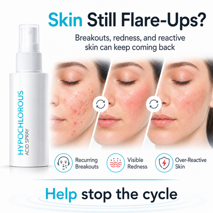 Dobshow® Hypochlorous Acid Facial Spray