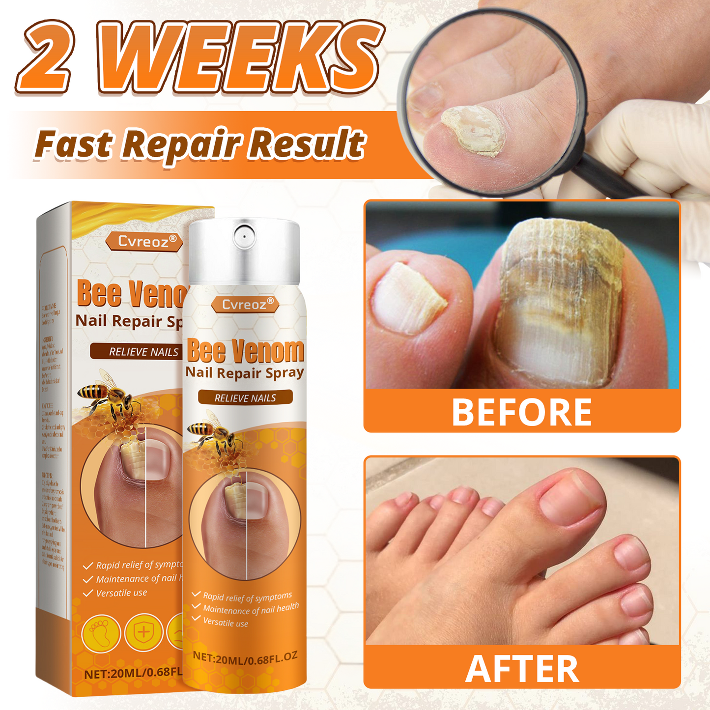 Cvreoz® Bee Venom Nail Repair Spray – Clinically Inspired Relief for Fungal & Damaged Nails🌺