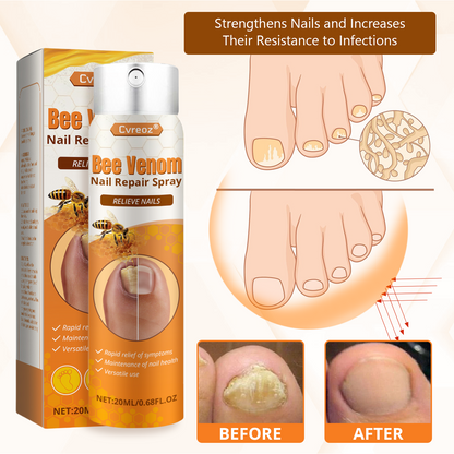 Cvreoz® Bee Venom Nail Repair Spray – Clinically Inspired Relief for Fungal & Damaged Nails🌺