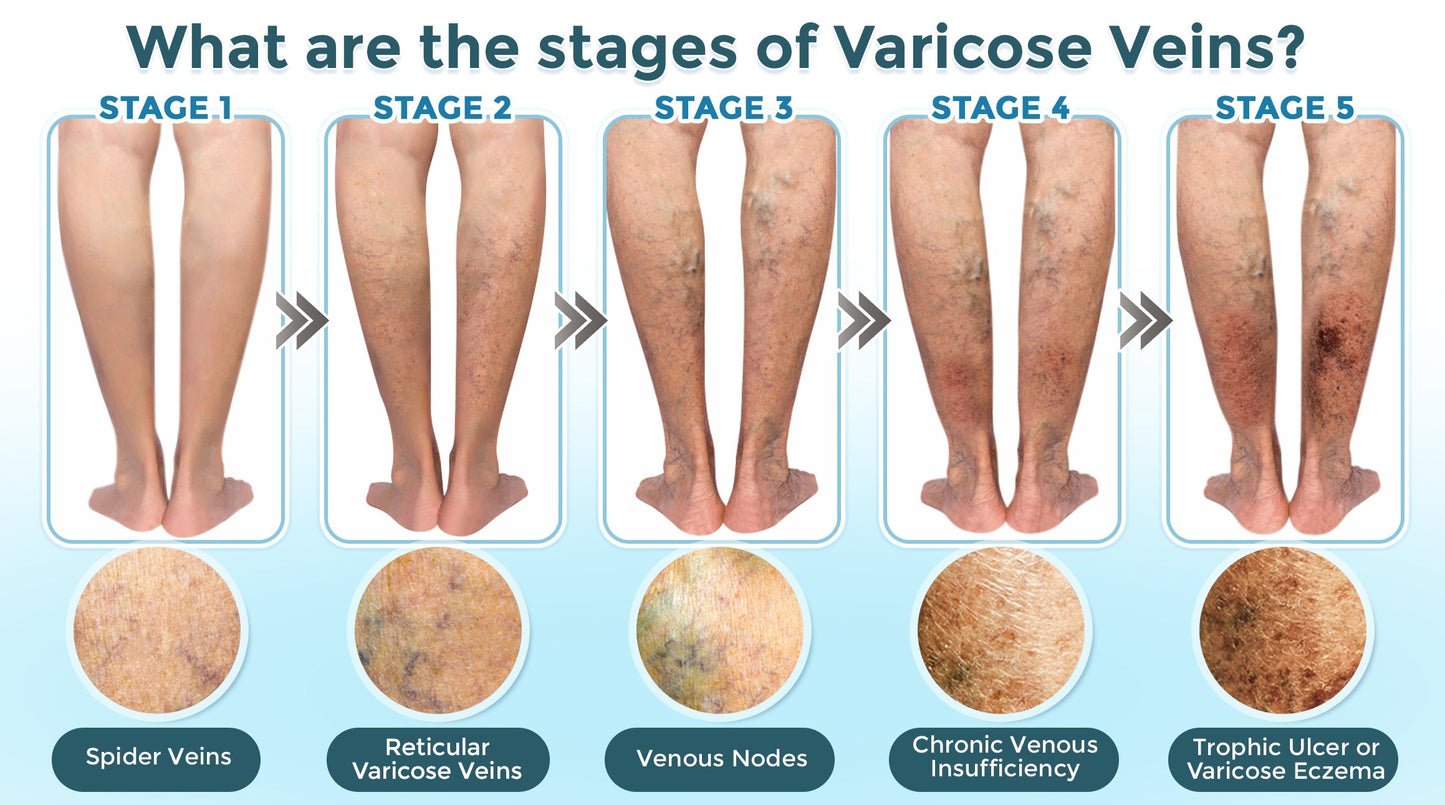 Cvreoz® VenaRestore MicroNeedle Vein Repair Patch