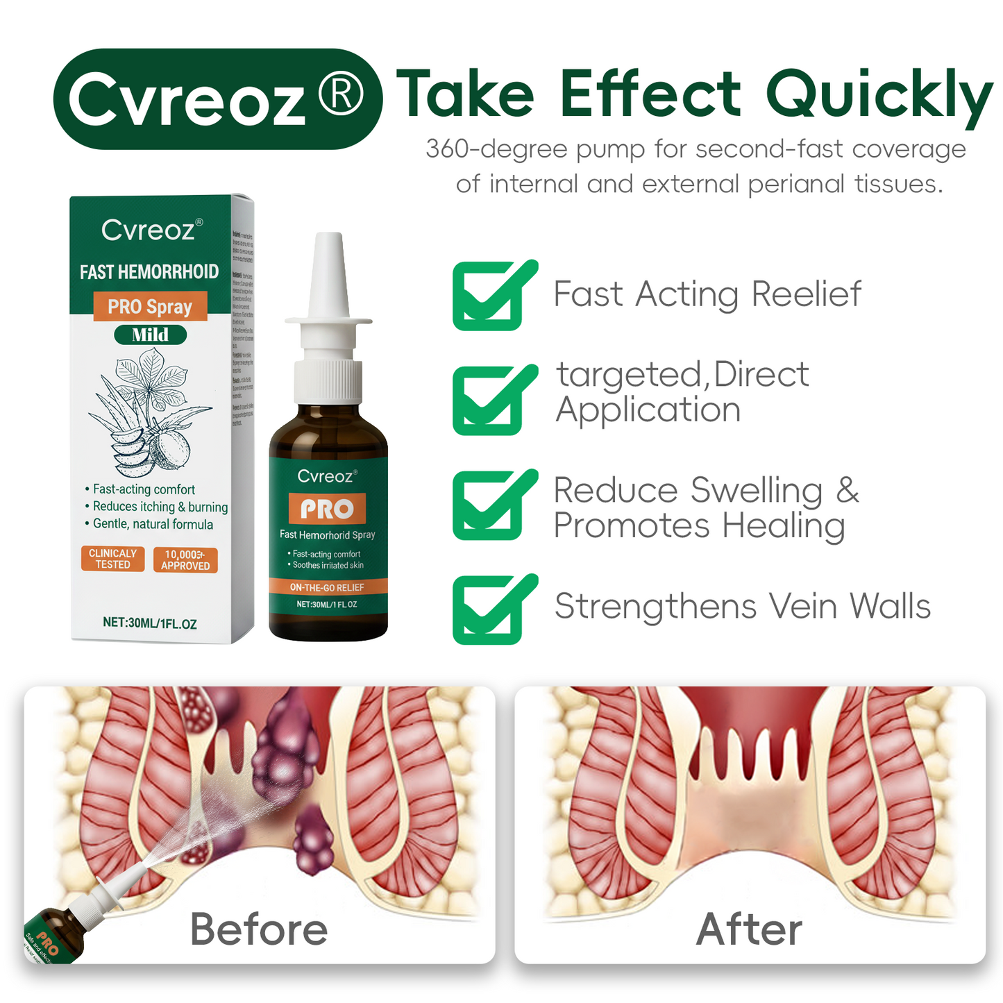 🔥Final 3 Hours: 80% OFF: Cvreoz® Fast Hemorrhoid PRO Spray